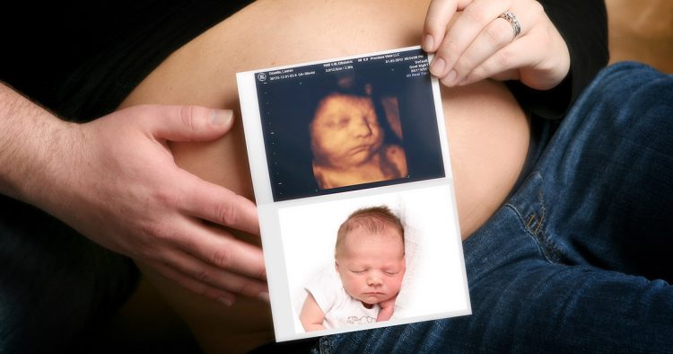 4d-ultrasound-image